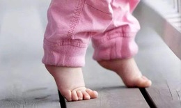 Một số tật về phát triển vận động thường gặp ở trẻ, cha mẹ nên biết để phát hiện sớm