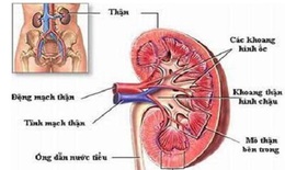Trị viêm bể thận cấp như thế nào?
