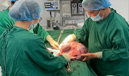 Cắt khối u buồng trứng khổng lồ nặng 10kg giải thoát cho cô gái trẻ

