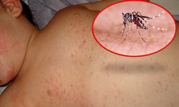 Đắk Lắk: Ca tử vong đầu tiên do sốt xuất huyết là trẻ 7 tuổi