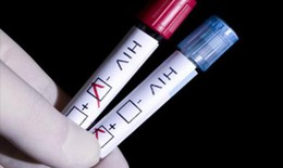 Điều kiện để xác định người bị phơi nhiễm với HIV do tai nạn rủi ro nghề nghiệp