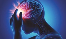Điểm mặt nguyên nhân và các yếu tố nguy cơ gây nhồi máu não
