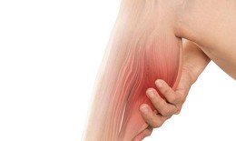 Chuột rút và biện pháp phòng ngừa
