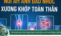 Đau nhức xương khớp v&#224; một số c&#225;c b&#224;i thuốc Đ&#244;ng y đơn giản trị bệnh