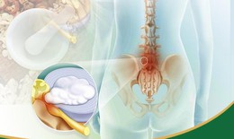 Bài thuốc chữa thoát vị đĩa đệm bằng Đông Y phối chế hơn 50 vị thuốc