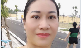 Cắt mí mắt đẹp theo cá nhân