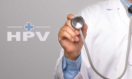 Nam giới c&#243; cần ti&#234;m vaccine ph&#242;ng HPV?