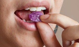 5 loại thực phẩm âm thầm tàn phá men răng nếu ăn sai cách