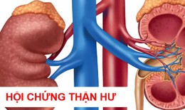 Hội chứng thận hư ở người lớn c&#243; nguy hiểm?