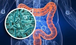 Ba chất bổ sung giúp đường ruột khỏe mạnh