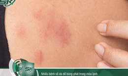 Những sai lầm gây bùng phát bệnh về da trong mùa lạnh