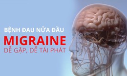 Bệnh đau nửa đầu điều trị như thế nào?