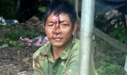 Phẫn nộ người chồng dùng điếu cày hành hung vợ vì không cho dùng điện thoại