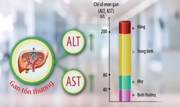 5 thủ phạm gây men gan cao, làm gì để hạ?