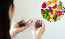 Thực phẩm làm chậm quá trình rụng tóc