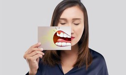 9 bài thuốc trị chứng hôi miệng do nóng trong