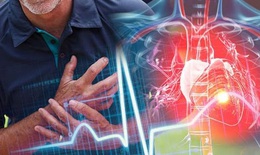 Phân biệt nhồi máu cơ tim và đột quỵ