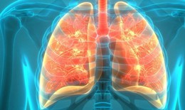 Biến chứng nguy hiểm của viêm phế quản cấp