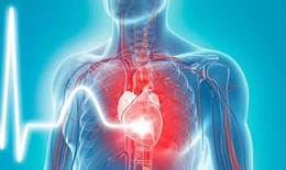 Bệnh lý tim mạch, mỡ máu, xơ vữa mạch máu, suy giảm đề kháng - Nguyên nhân và cách phòng ngừa