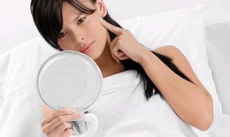 Tăng sắc tố da ở phụ nữ mang thai và sau sinh, ứng phó thế nào?