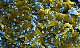 WHO hy vọng sớm thử nghiệm vaccine ngừa Marburg, virus gây 9 ca tử vong ở Guinea Xích đạo