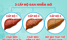 4 món ăn bài thuốc phòng trị gan nhiễm mỡ