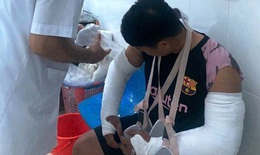 Thông tin mới nhất vụ shipper bị đánh gãy hai tay ở Quảng Ngãi