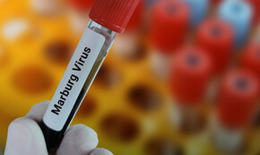 TP.HCM nâng cao cảnh giác với bệnh do virus Marburg