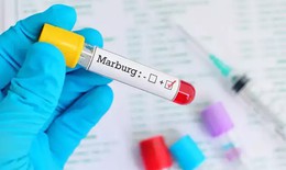 Chuyên gia Nhật Bản nói gì về bệnh Marburg?