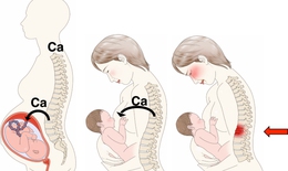 Vì sao phụ nữ sau sinh bị loãng xương?