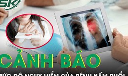 Cảnh báo mức độ nguy hiểm của bệnh nấm phổi