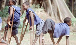 Lịch sử căn bệnh bại liệt hoang dại v&#224; c&#225;ch tốt nhất để ngăn ngừa