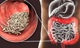 Tỷ lệ người dân nhiễm ký sinh trùng cao, Nghệ An đẩy mạnh phòng, chống