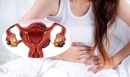 Cứ đến tháng máu lại rỉ từ vết mổ đẻ cũ là triệu chứng của bệnh gì?