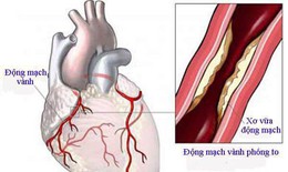Đường ruột tác động đến sức khỏe tim mạch như thế nào?
