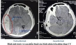 Lãnh đạo Bệnh viện ‘tự ý’ ký giấy mổ cứu bệnh nhân tai nạn giao thông thoát cửa tử