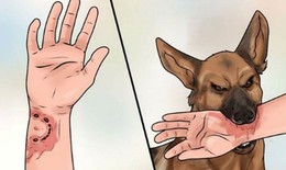 TP.HCM chỉ đạo khẩn tăng cường các biện pháp cấp bách phòng, chống bệnh dại