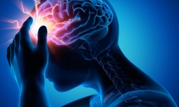 Viêm màng não - viêm não: Chẩn đoán và phân biệt
