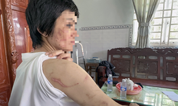 Người chồng bị tố bạo hành dã man vợ mang bầu 7 tháng khai gì?