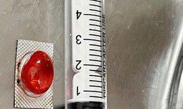 Hy hữu: Người đàn ông nhập viện vì uống thuốc quên bóc vỏ