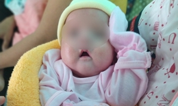 Khoa Sơ sinh Bệnh viện Nhi Đồng Cần Thơ - 'Mái nhà' của trẻ sơ sinh non tháng