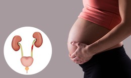 Nhận biết dấu hiệu viêm đường tiết niệu ở mẹ bầu để điều trị sớm, ngừa biến chứng