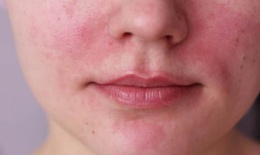 Các vấn đề về da và tóc phổ biến mà phụ nữ phải đối mặt