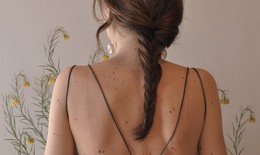 Mẹo chăm sóc cải thiện tình trạng viêm nang lông