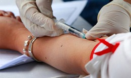 T&#236;m ca nhiễm HIV mới, B&#236;nh Dương tăng cường truyền th&#244;ng nh&#243;m nhỏ, b&#225;m s&#225;t cộng đồng MSM