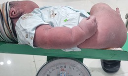 Hy hữu sản phụ sinh thường b&#233; trai nặng 5kg