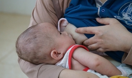 Ph&#242;ng, chống suy dinh dưỡng cho trẻ nhỏ bằng sữa mẹ