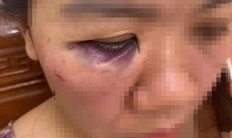 Tạm đình chỉ 2 công nhân điện lực Hà Tĩnh xô xát đến nhập viện