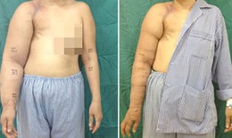Căn bệnh khiến người phụ nữ 25 năm khổ sở muốn cắt bỏ c&#225;nh tay