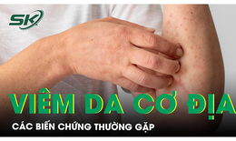 Biến chứng của vi&#234;m da cơ địa